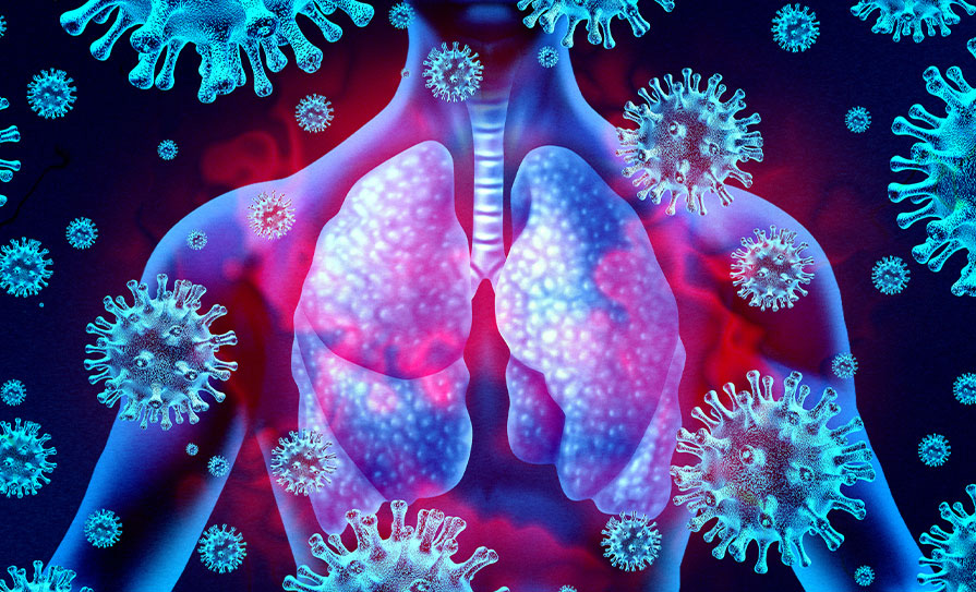 Respiratory Diseases