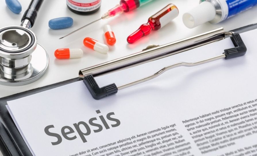 sepsis