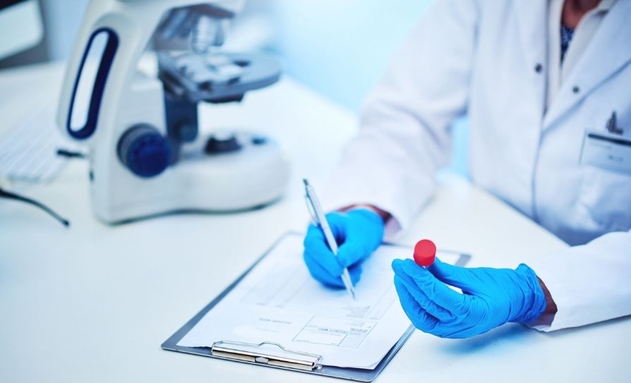 steroid hormone levels
