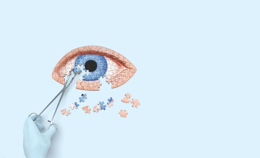 eyes