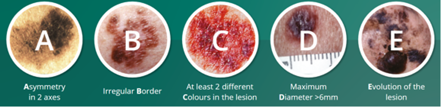 lesions