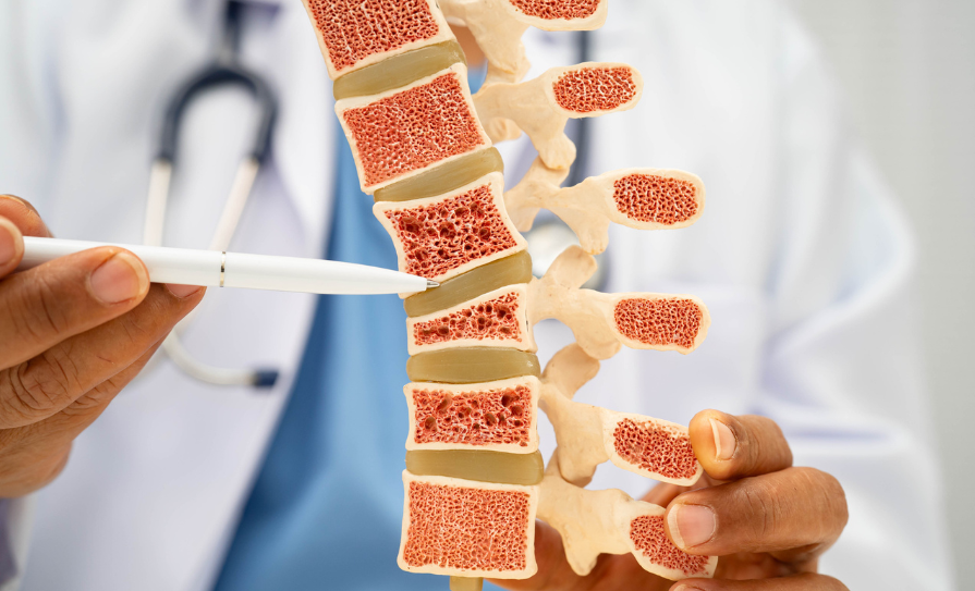 osteoporosis