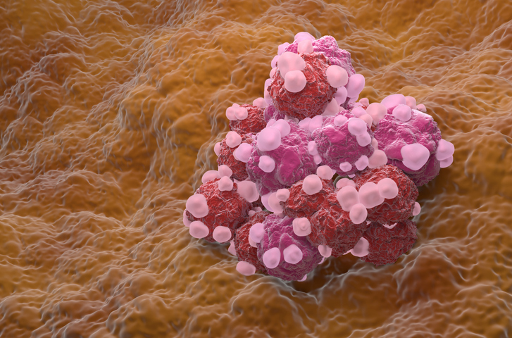 Slowing tumour growth